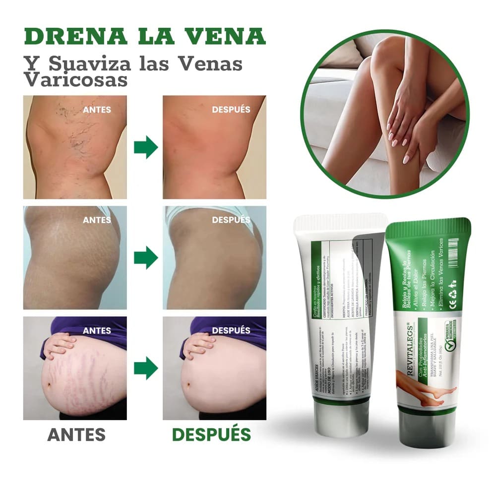 Revitalegs® - Crema para Eliminar Venas Varices
