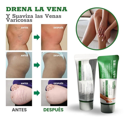 Revitalegs® - Crema para Eliminar Venas Varices